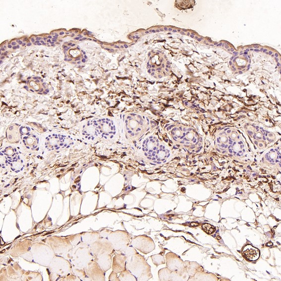 m01811 ihc10