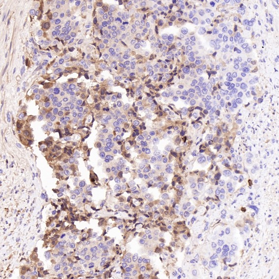 m01811 ihc8