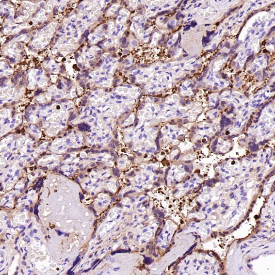 m01811 ihc9