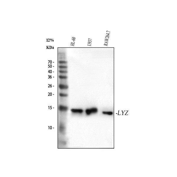  Western blot analysis of Lysozyme using anti-Lysozyme antibody (M01811)