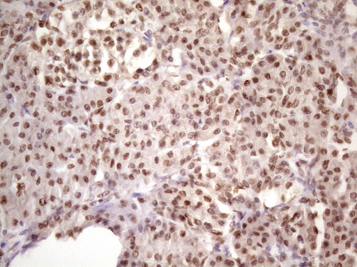 Immunohistochemical staining of paraffin-embedded Human pancreas tissue within the normal limits using anti-IKBKE mouse monoclonal antibody