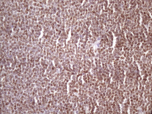 m01816 1 anti ikbke mouse monoclonal antibody clone id oti3c5 ihc testing 6