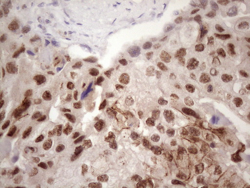 m01816 1 anti ikbke mouse monoclonal antibody clone id oti3c5 ihc testing 7