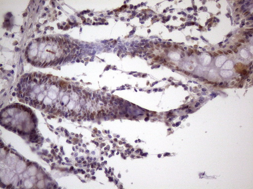 m01816 1 anti ikbke mouse monoclonal antibody clone id oti3c5 ihc testing 8