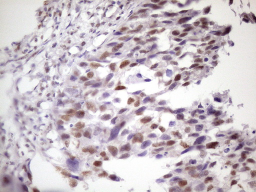 m01816 1 anti ikbke mouse monoclonal antibody clone id oti3c5 ihc testing 9