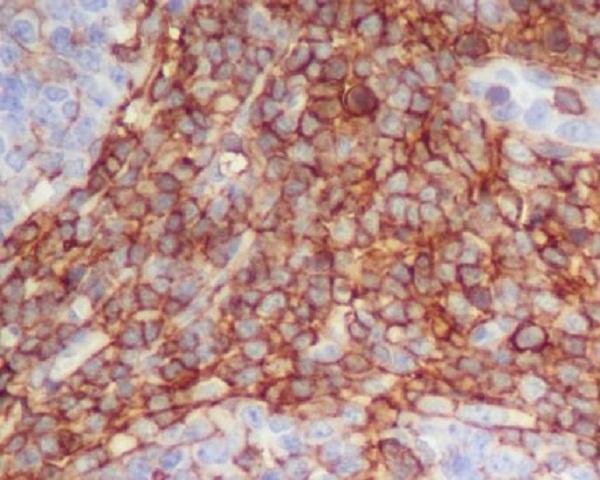 Immunohistochemical analysis of paraffin-embedded human tonsil, using CD90 / Thy1 Antibody
