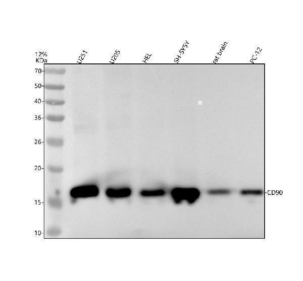 Western blot analysis of CD90/THY1 using anti-CD90/THY1 antibody (M01818)
