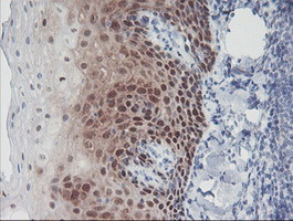 Immunohistochemical staining of paraffin-embedded Human tonsil within the normal limits using anti-IRF6 mouse monoclonal antibody