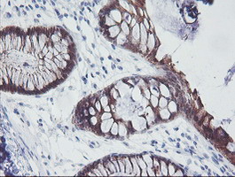m01822 1 anti irf6 mouse monoclonal antibody clone id oti2c10 ihc testing 11
