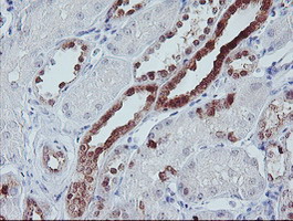 m01822 1 anti irf6 mouse monoclonal antibody clone id oti2c10 ihc testing 12