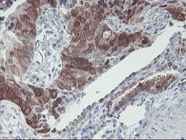 m01822 1 anti irf6 mouse monoclonal antibody clone id oti2c10 ihc testing 3