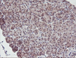 m01822 1 anti irf6 mouse monoclonal antibody clone id oti2c10 ihc testing 4
