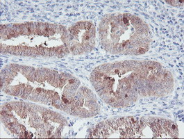m01822 1 anti irf6 mouse monoclonal antibody clone id oti2c10 ihc testing 5