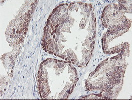 m01822 1 anti irf6 mouse monoclonal antibody clone id oti2c10 ihc testing 6