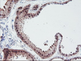 m01822 1 anti irf6 mouse monoclonal antibody clone id oti2c10 ihc testing 7