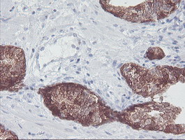 m01822 1 anti irf6 mouse monoclonal antibody clone id oti2c10 ihc testing 8