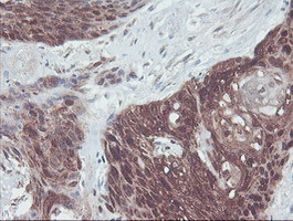 m01822 1 anti irf6 mouse monoclonal antibody clone id oti2c10 ihc testing 9