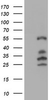 m01822 1 anti irf6 mouse monoclonal antibody clone id oti2c10 wb testing 1