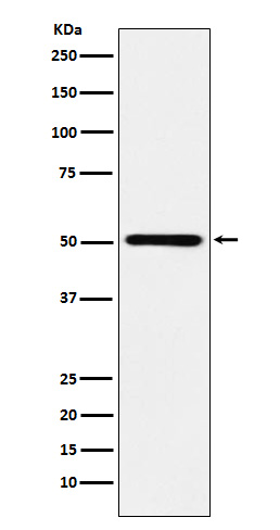 Western blot analysis of RING1 expression in Ramos cell lysate