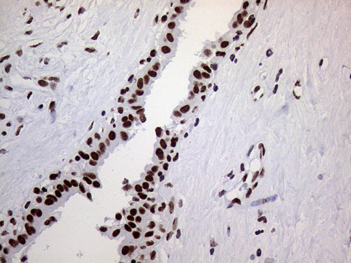 m01824 anti ring1 mouse monoclonal antibody clone id oti3g7 ihc testing 10