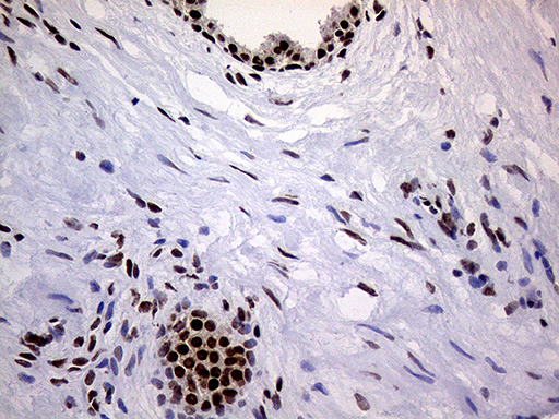 m01824 anti ring1 mouse monoclonal antibody clone id oti3g7 ihc testing 11