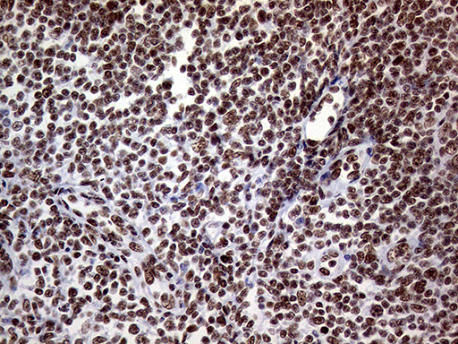 m01824 anti ring1 mouse monoclonal antibody clone id oti3g7 ihc testing 12