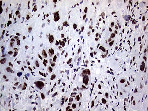m01824 anti ring1 mouse monoclonal antibody clone id oti3g7 ihc testing 13