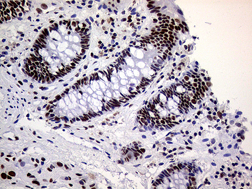 m01824 anti ring1 mouse monoclonal antibody clone id oti3g7 ihc testing 14