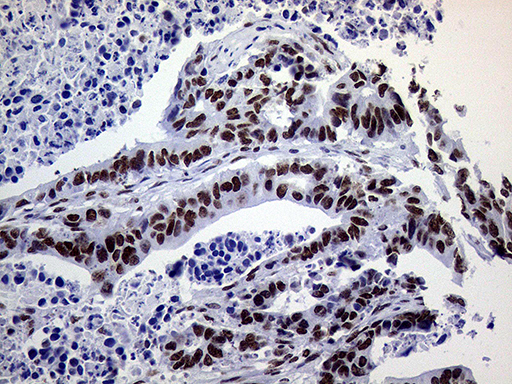 m01824 anti ring1 mouse monoclonal antibody clone id oti3g7 ihc testing 15