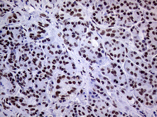 m01824 anti ring1 mouse monoclonal antibody clone id oti3g7 ihc testing 5