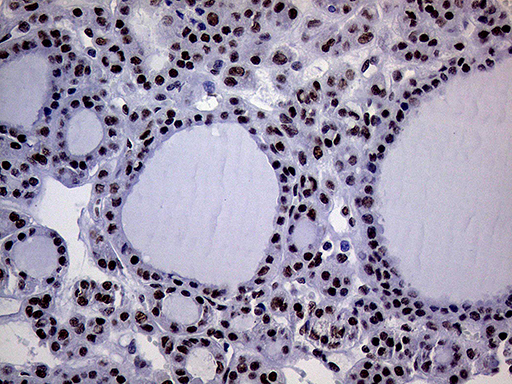 m01824 anti ring1 mouse monoclonal antibody clone id oti3g7 ihc testing 6