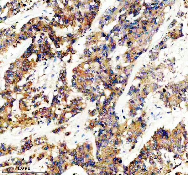 IHC analysis of GLB1 using anti-GLB1 antibody (M01829-3)