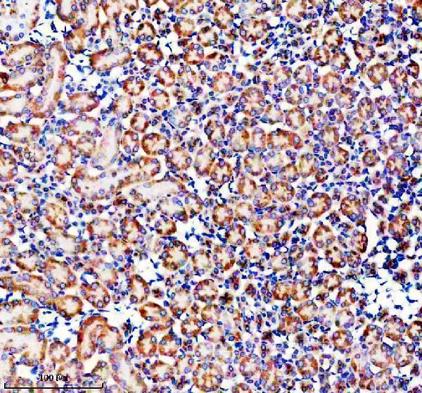 IHC analysis of GLB1 using anti-GLB1 antibody (M01829-3)