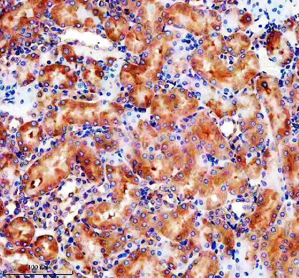 IHC analysis of GLB1 using anti-GLB1 antibody (M01829-3)