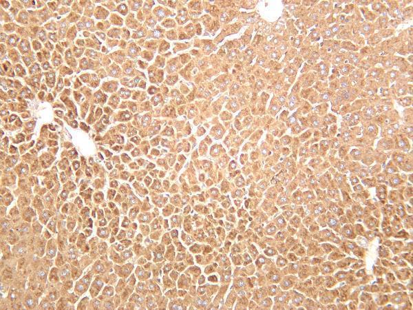 Mouse liver was stained with anti-β-Galactosidase rabbit antibody