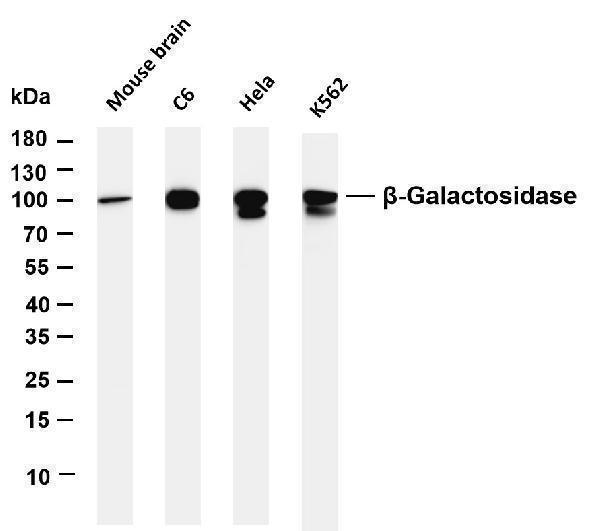Various whole cell lysates were separated by 4-20% SDS-PAGE, and the membrane was blotted with anti-β-Galactosidase antibody