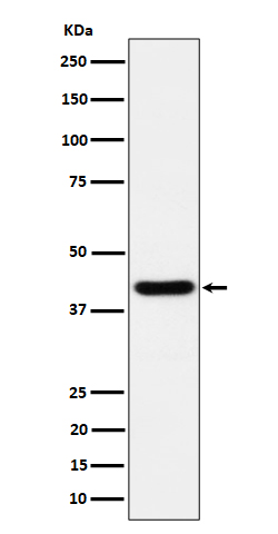 Western blot analysis of Spermine synthase expression in HeLa cell lysate