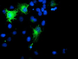 m01831 anti spermine synthase sms mouse monoclonal antibody clone id oti3c9 if testing 12