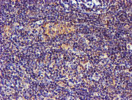 m01831 anti spermine synthase sms mouse monoclonal antibody clone id oti3c9 ihc testing 5