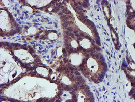 m01831 anti spermine synthase sms mouse monoclonal antibody clone id oti3c9 ihc testing 7