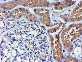 m01831 anti spermine synthase sms mouse monoclonal antibody clone id oti3c9 ihc testing 8