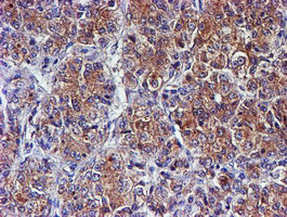 m01831 anti spermine synthase sms mouse monoclonal antibody clone id oti3c9 ihc testing 9