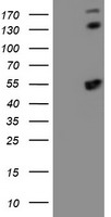 HEK293T cells were transfected with the pCMV6-ENTRY control (Left lane) or pCMV6-ENTRY SMS (Right lane) cDNA for 48 hrs and lysed