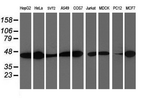 Western blot analysis of extracts (35ug) from 9 different cell lines by using anti-SMS monoclonal antibody