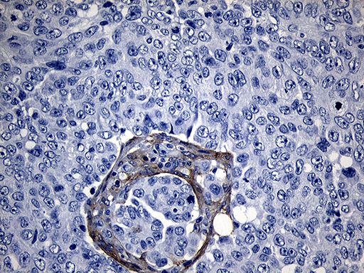 m01840 anti ror2 mouse monoclonal antibody clone id oti4b10 ihc testing 3