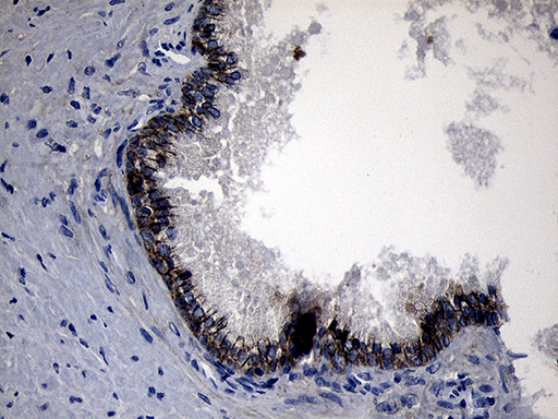 m01840 anti ror2 mouse monoclonal antibody clone id oti4b10 ihc testing 4