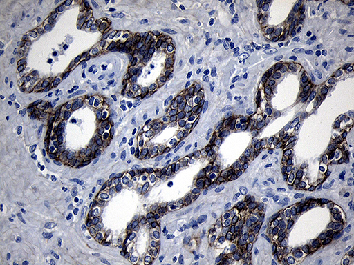 m01840 anti ror2 mouse monoclonal antibody clone id oti4b10 ihc testing 5