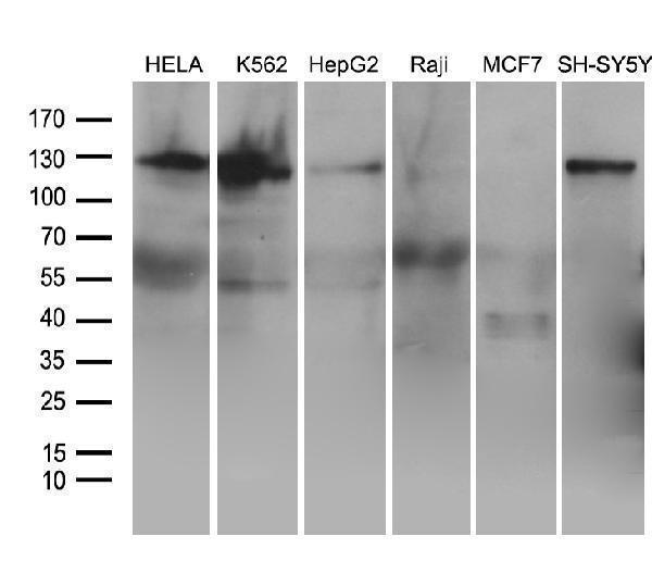 m01840 anti ror2 mouse monoclonal antibody clone id oti4b10 wb testing 2