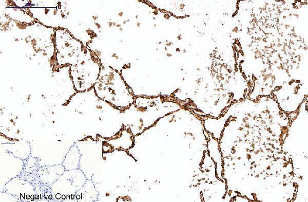 Immunohistochemistry validation of PRDX1 using Anti-Peroxiredoxin 1 PRDX1 Monoclonal Antibody (M01845-2)