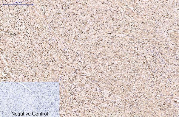 Immunohistochemistry validation of PRDX1 using Anti-Peroxiredoxin 1 PRDX1 Monoclonal Antibody (M01845-2)
